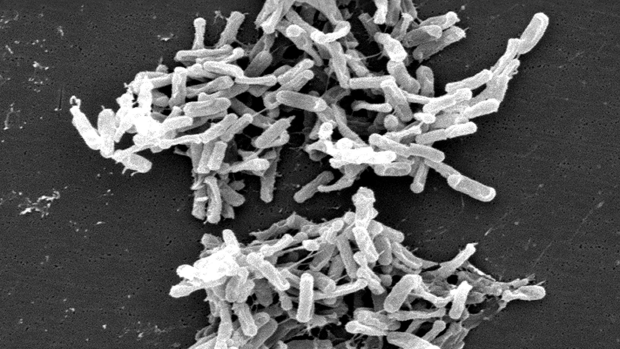15788_clostridium_difficile_01_519141-1